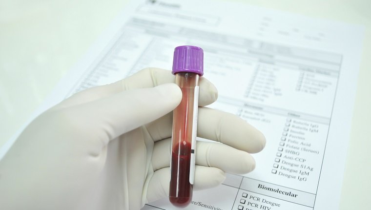 blood tube in hand of scientist