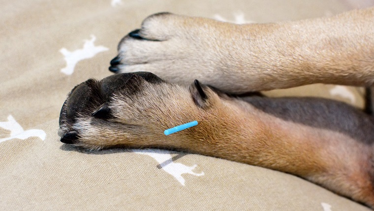 acupuncture