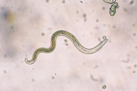 Toxocara canis second stage larvae hatch from eggs in microscope. Toxocariasis, also known as Roundworm Infection, causes disease in humans